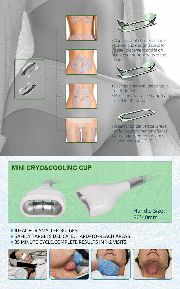 Ручки машины 7 салона красоты 800W Cryolipolysis с кавитацией RF