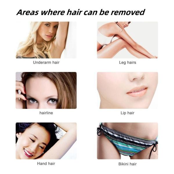 Three Different Wavelength Opt Ipl Nd Yag Laser Hair Removal Machine