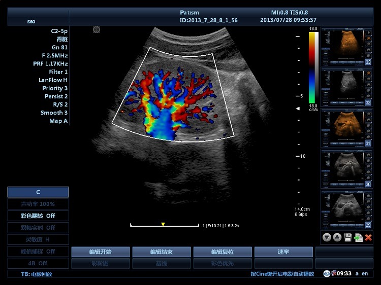 Hospital Outside Trolley 15Inch Ultrasound Machine Ultrasound Digital Color Doppler Ultrasound Machines edical