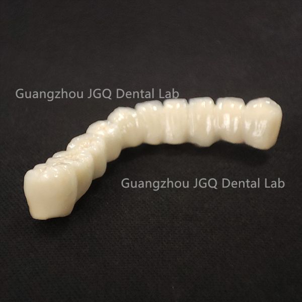 Dental Pfm Crown and Bridge Restorations for Dental Care China Dental Laboratory