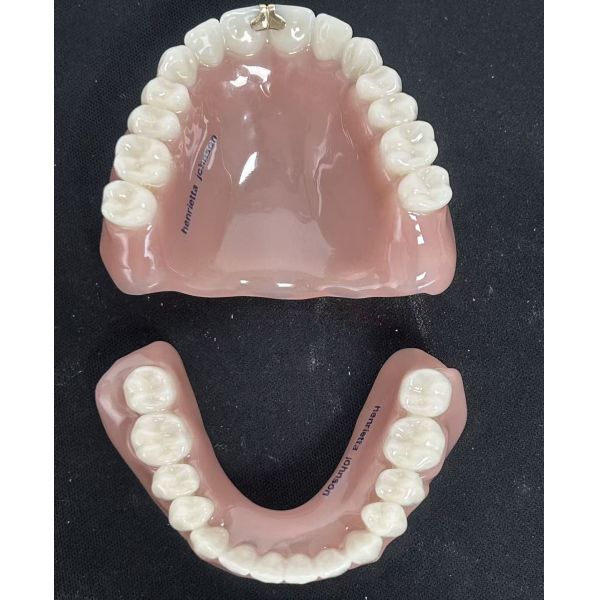 Custom Full Denture with Natural Appearance and Comfortable Fit for Complete Arch Restoration