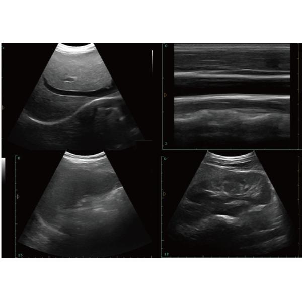 9.7 Inch Touch Screen Control Panel Battery Veterinary Portable Ultrasound USB Diagonosis Pregnant Ultrasound