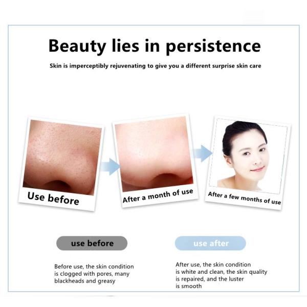 Electric Galvanic Ultrasonic Skin Cleanser Rechargeable