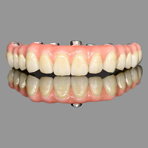 ADL Dental Iaboratories limited | Class I AOX Implants All On 4 Hybrid Titanium Screw Retained Full Zirconia
