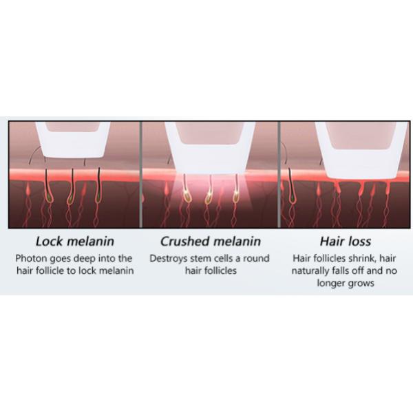 AC110V Freckle Removal Machine Ipl Laser Hair Removal Device