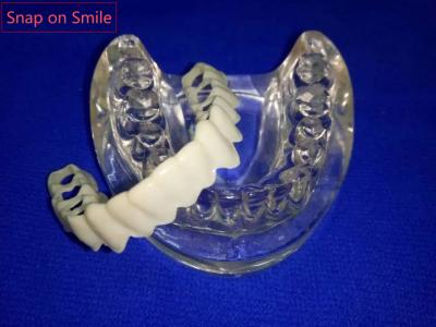 Snap on Smile