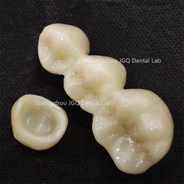 Hypoallergenic Zirconia Crown Bridge For Permanent Dental Implants