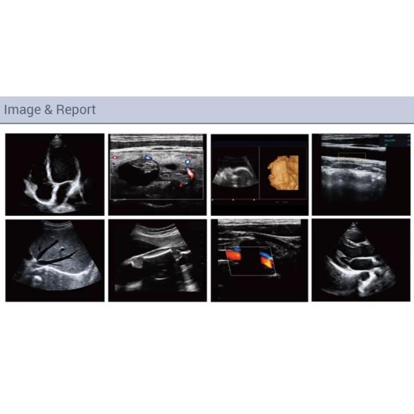 Машина блока развертки ультразвука Doppler цвета Figital сердечнососудистой кардиологии портативная полная