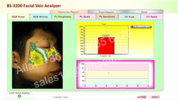 canon camera skin analyzer beauty equipment digital camera visia skin analysis machine