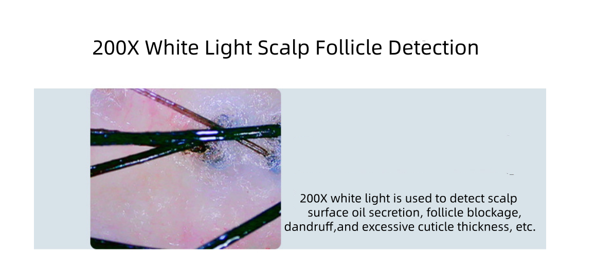 Máquina analizadora de cabello HD portátil para salón, tratamiento para el crecimiento del folículo piloso