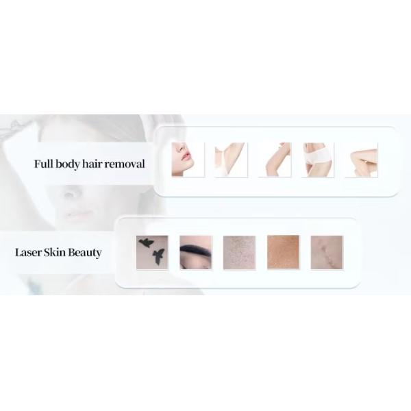 2024 OEM Профессиональный лазерный эпилятор 3 волны диодный лазер 755 808 1064 Яг лазер