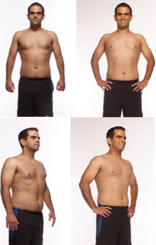 Safety Coolsculpting Slimming Beauty Machine For Fat Reduction / Body Contouring