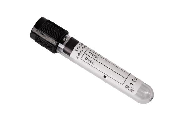 Tube de prélèvement sanguin ESR 2 ml avec anticoagulant citrate de sodium