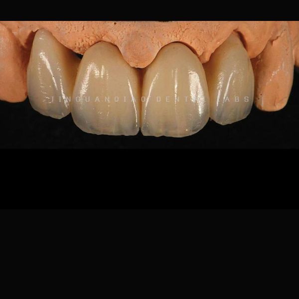CNC Precision Milled Zirconia Crowns Bridges Layered / Monolithic Zirconia Restoration