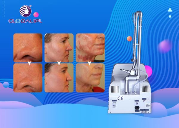 Portable Fractional CO2 Laser Machine for Skin Rejuvenation  Scar Removal and Vaginal Therapy