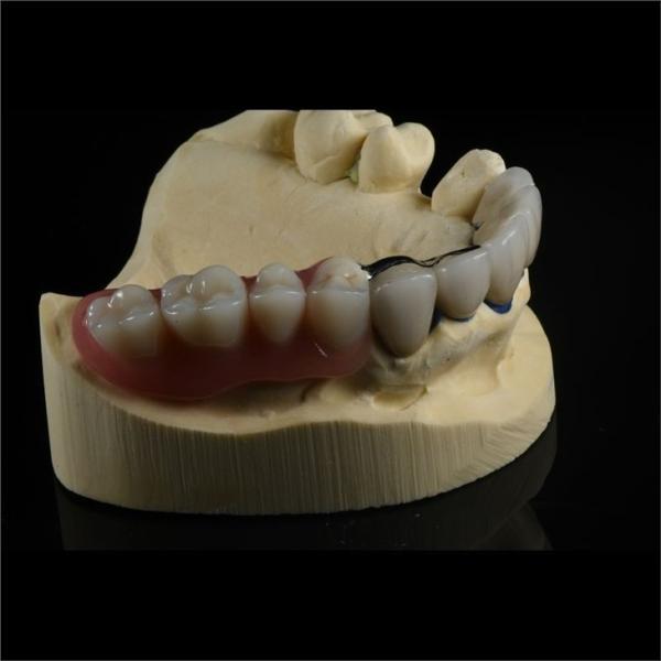 Precision Zirconia PFM Crowns Partial Dentures Natural Looking