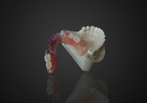 Lightweight Comfortable Valplast Partial Denture Easy Cleaning High Transparency