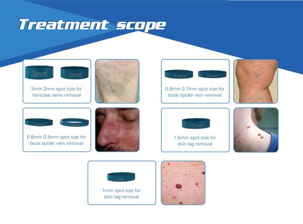 Top quality touching screen operating mode 980nm diode laser varicose spider veins removal treatment