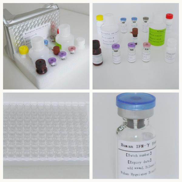 Accuracy And Sensitive Elisa Test Kit For Fast And Easy Detection TB IGRA ELISA DIAGNOSIS