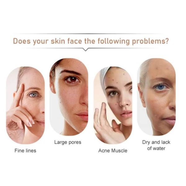 Анти- старея игла вводимое Mesotherapy младенца ракеты -носителя PDRN кожи