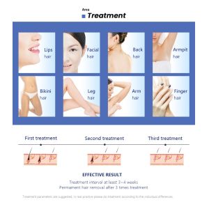 машина обработки выпадения волос машины удаления волос лазера диода 3500В 808 Нм