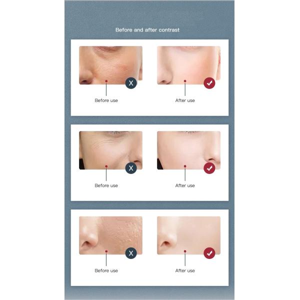 Facial Red Light PDT LED Light Therapy Machine 24W 6 Colour For Acne