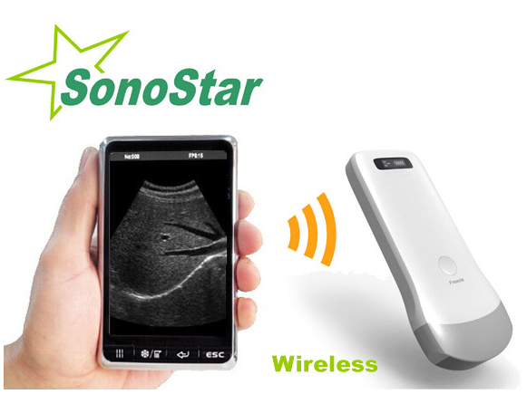 PC based 3D Ultrasound Machine SS-9 Laptop Ultrasound scanner