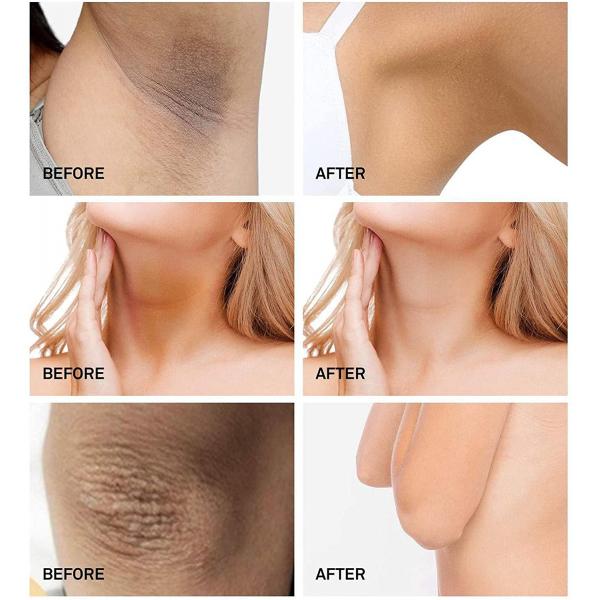 Wholesale Dark Knees And Elbows Strong Whitening Cream Fast Action Extreme Whitening Cream