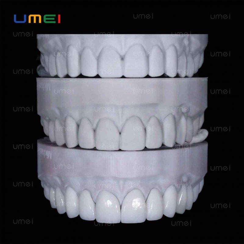 Strong Dental Veneer Minimally Invasive Dental Clinic Veneers Ultra Thin