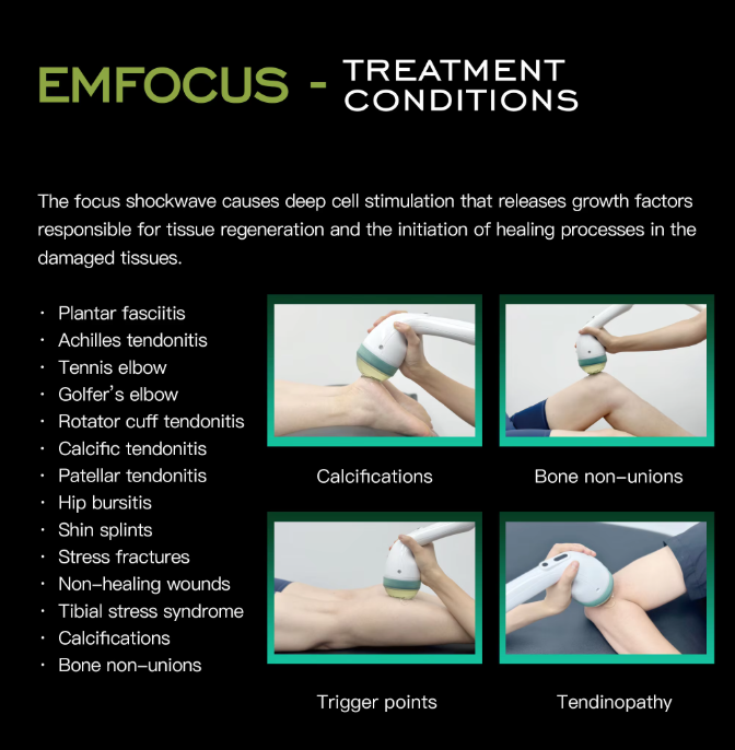 Emfocus Focused Shock Wave Therapy Machine Focused Shockwave Physiotherapy for Sports Rehabilitation Pain Relieves