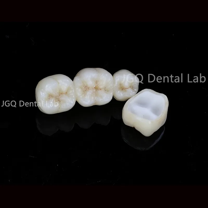 China Dental Lab Digital Full Dentures Using CAD/Cam Technology 3D Printing and Skilled Technicians