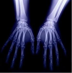 Digital Medical Diagnostic Imaging , 8 x 10 CT X-ray Dry Film