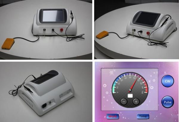 RBS 30MHz high frequency machine / varicose veins laser treatment for spider vein removal