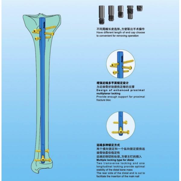 подход к Suprapatellar ногтя титана 180-360mm большеберцовый блокируя