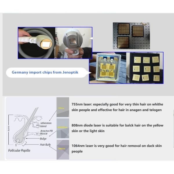 755nm / 808nm / 1064nm Combiantion Professional Laser Hair Removal Machine