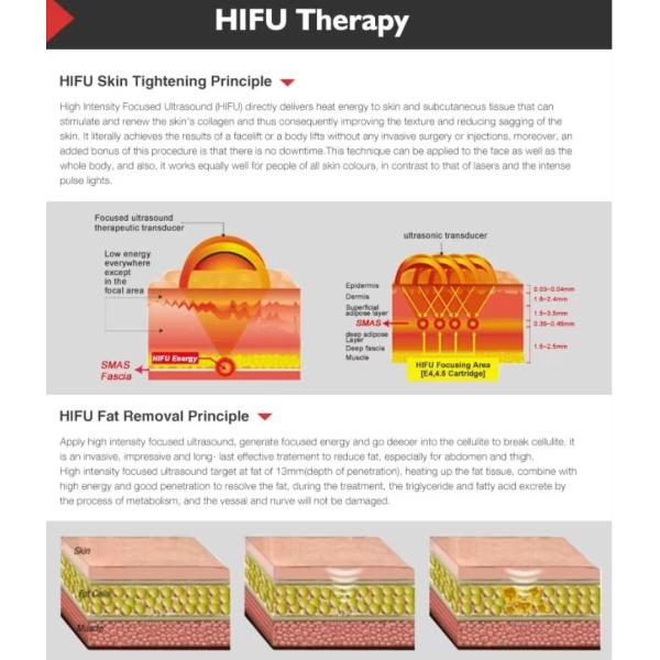 Machine 4D HIFU Liposonique Corps et Visage pour le Remodelage Corporel et le Lifting Cutané, Réduction des Rides