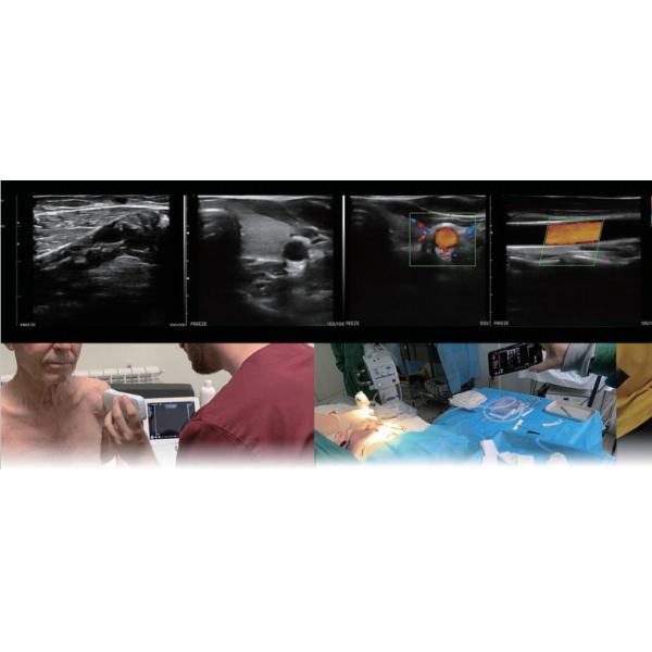 GH 192 Elements Color Doppler Ultrasound Wireless Linear Probe 7.5mhz 10mhz G10CX