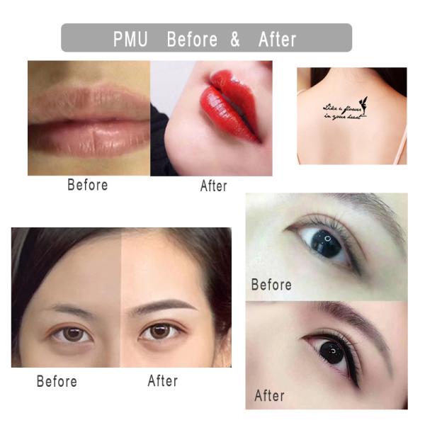 Dr.Pen M7-W Wireless Microneedling Cartridge Device Skin Tightening Micro Needle Stimulate Electric Stamp Dermapen