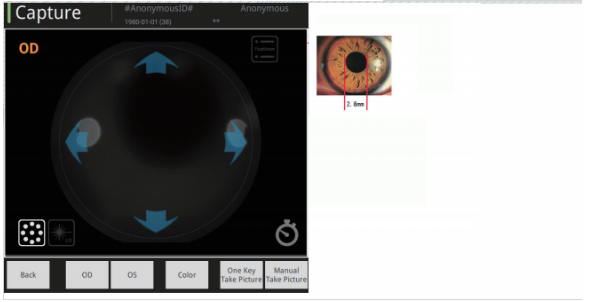 Ретинальная отображая система оборудования 13mm камеры изображений Fundus HD двойная