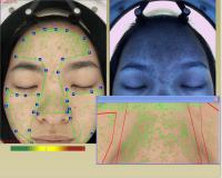 Máquina facial profissional do analisador da hidratação da pele 3d com tela táctil