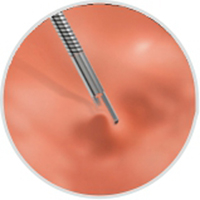 Продукты устранимого Эндоскопик зажима Хемо медицинские потребляемые 2 лет гарантии