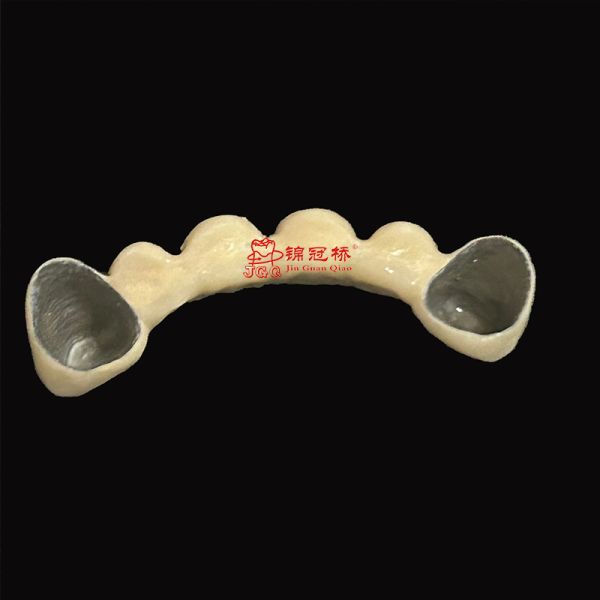 Customized Pfm Titanium Teeth Durable Corrosion Resistant Ensuring Longevity