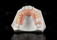 White And Pink Peek Flexible Acrylic Partial Denture With Excellent Resistance