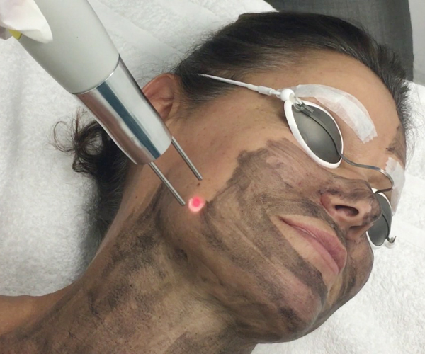 Ce Approval Long Pulsed Nd Yag Laser , 800w Yag Laser Tattoo Removal Machine