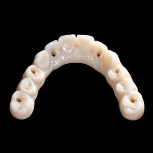 Zirconia Crown Bridge