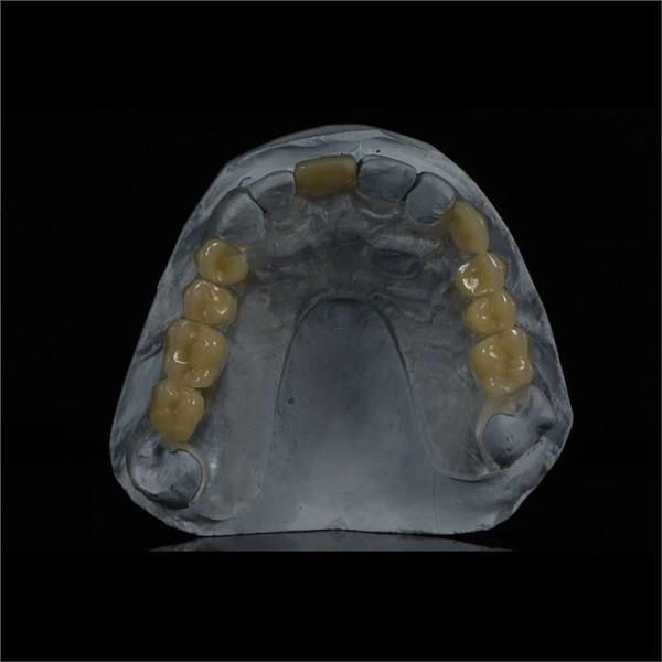 Removable Lower Upper Partial Acrylic Denture For Missing Teeth
