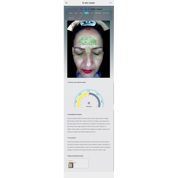 Skin Analyzer Reports Bitmoji Max Plus Facial Scanner Skin Scope Analysis Device