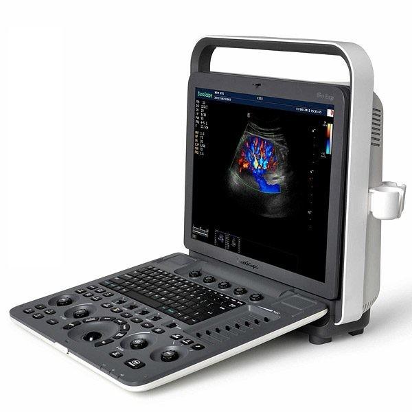 Anti Glare Screen 2D Portable SonoScape Ultrasound Machine S8 Exp