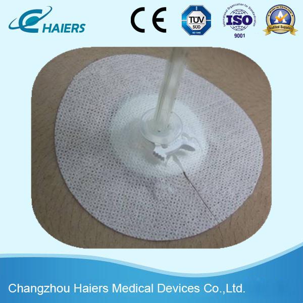 4/6/8/10/12 Full Size Disposable Drainage Catheter Fixation Devices