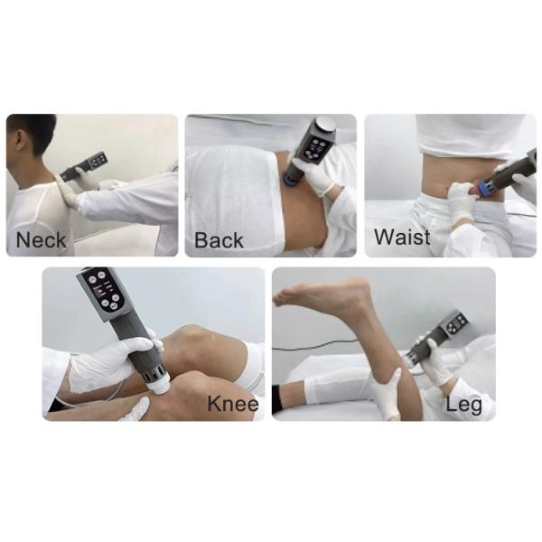 200мж радиальная ударная волна терапия для теннисиста локтевой и суставной боли